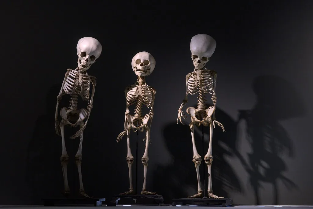 Skeletons in the anatomical collection of the University Museum, Groningen.